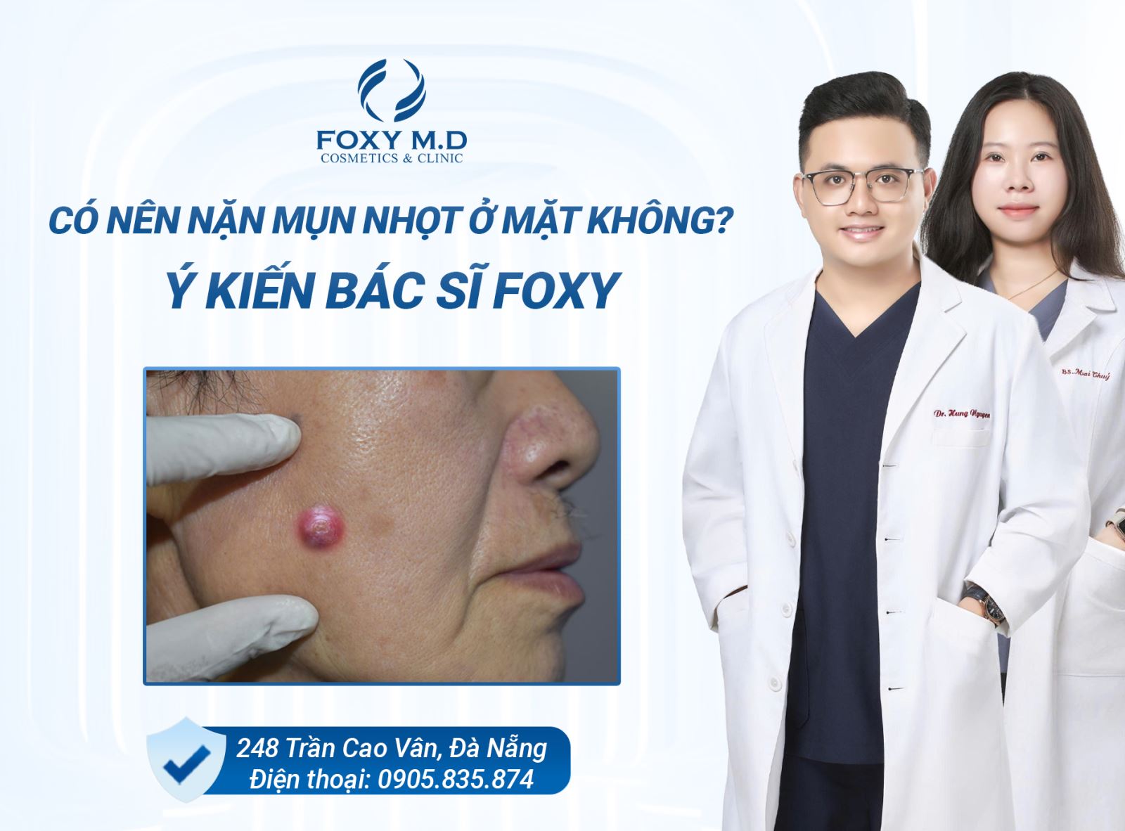 Có nên nặn mụn nhọt ở mặt không? Ý kiến bác sĩ Foxy